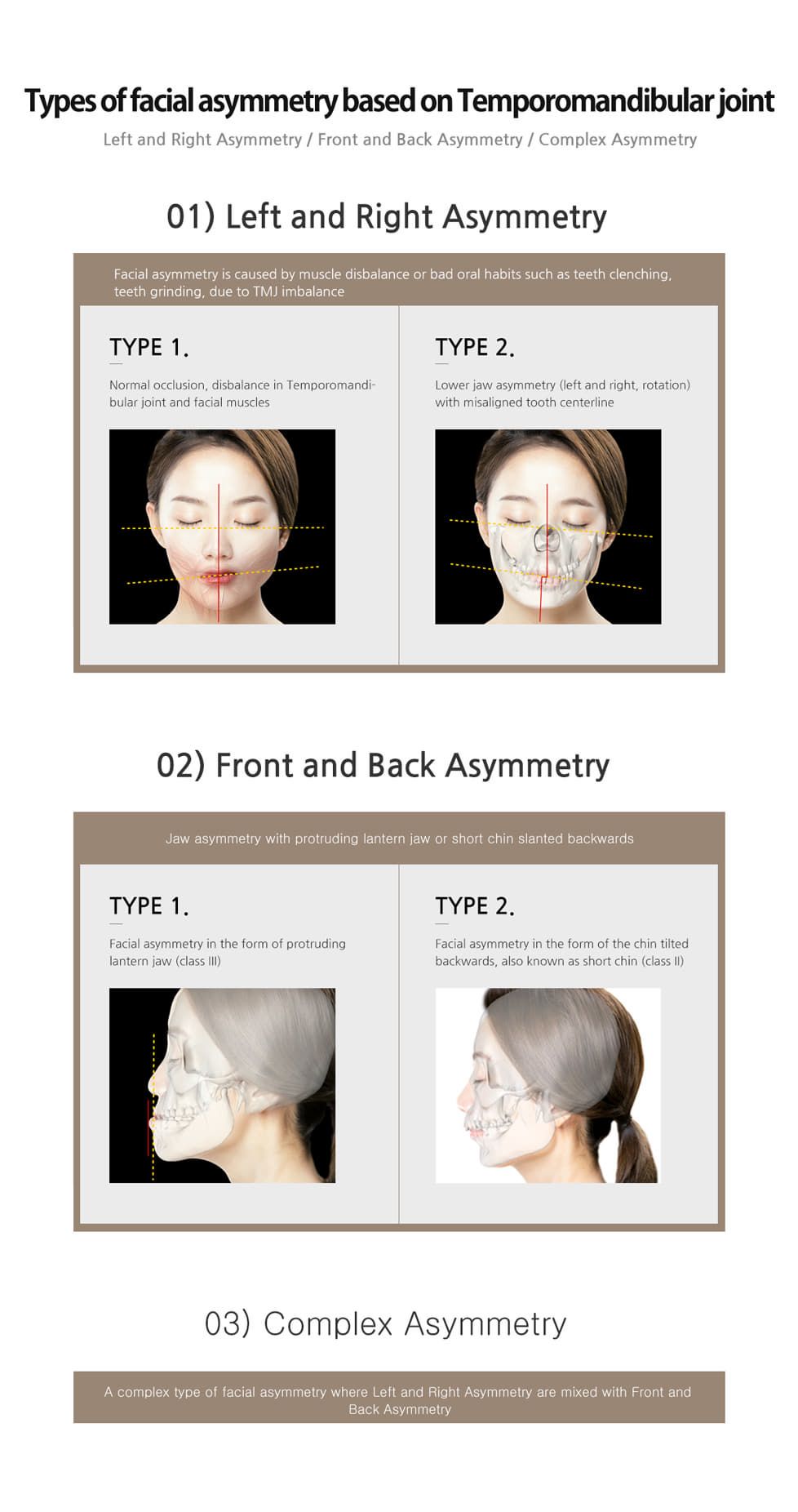 facial asymmetrycial asymmetry
