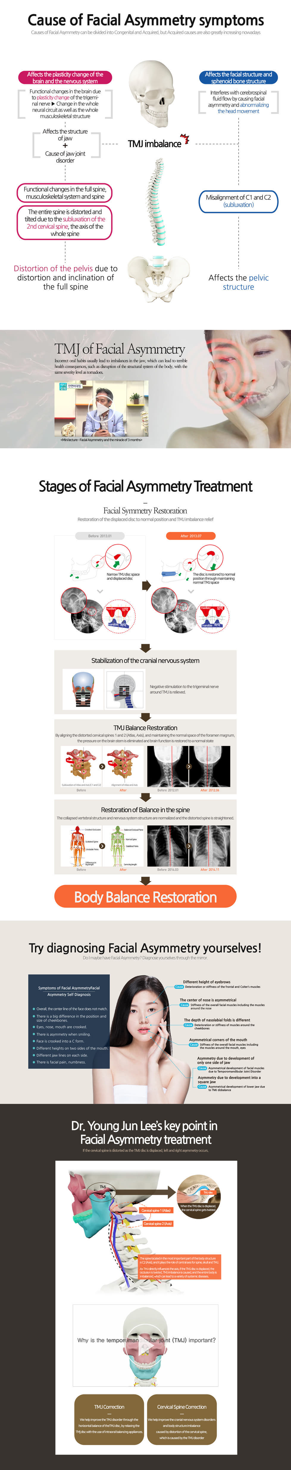 facial asymmetrycial asymmetry